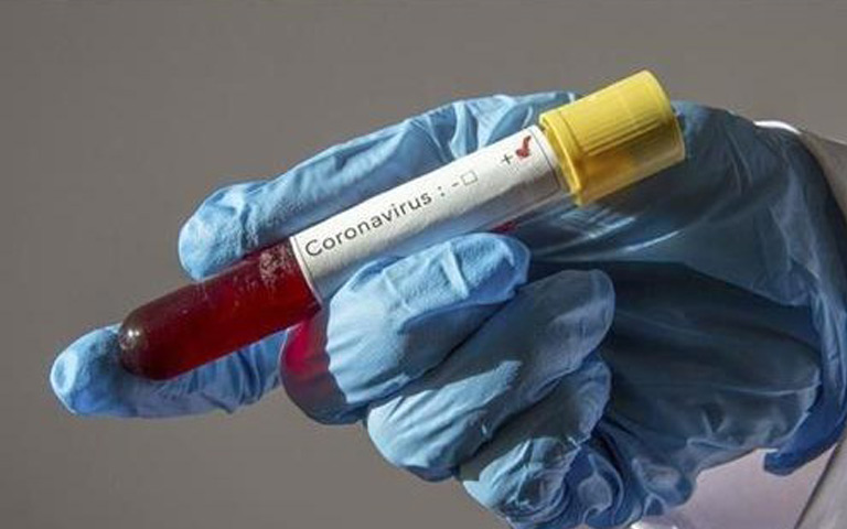coronavirus-covid-19-world-7-lakh-infected