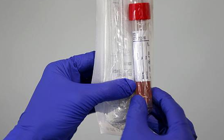 coronavirus-cheap-test-kit-iit-delhi