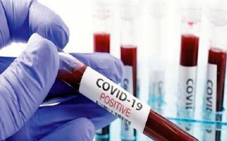 9-positive-corona-cases-virus-in-panchkula