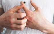 Identify Diabetes by these 6 warning symptom of skin