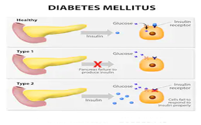 Everything-You-Need-to-Know-About-Diabetes