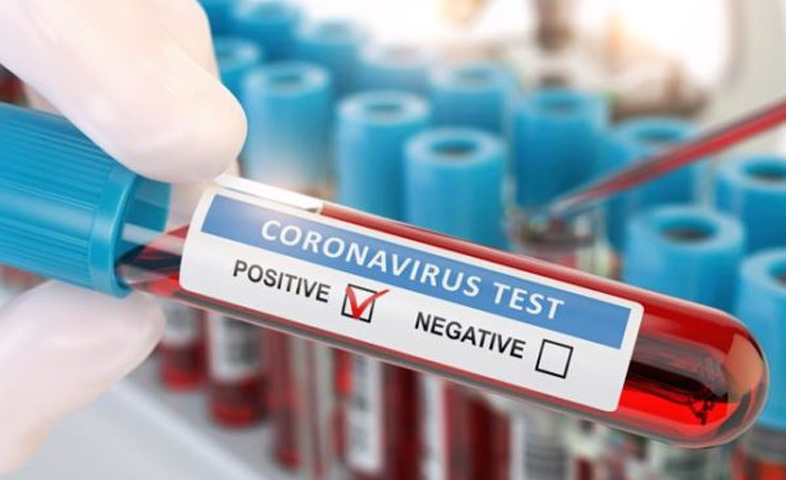 Positive rate of corona patients decreases